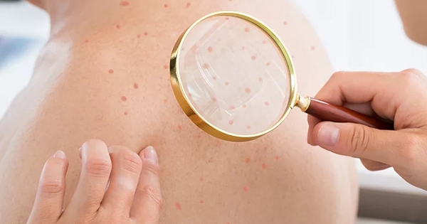 Đi khám da, bàng hoàng phát hiện nhiễm HIV: Tất cả chỉ vì 1 sai lầm của nhiều năm trước