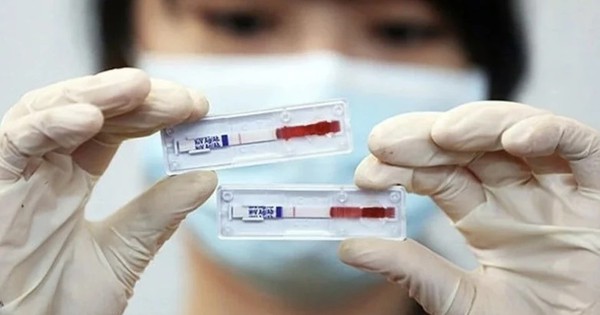Một nước Đông Nam Á báo động tình trạng lây nhiễm HIV, hàng chục ca mắc mới mỗi ngày