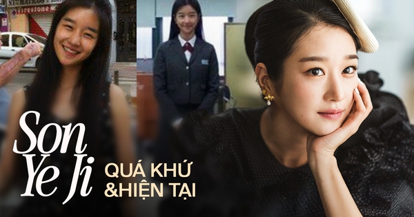 "Điên nữ" đóng cùng Kim Soo Hyun sở hữu nhan sắc gây sốt, soi lại ảnh quá khứ dễ dàng nhận thấy 3 sự thay đổi đúng đắn để visual thần thái cỡ này