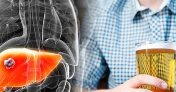 5 loại nước tàn phá gan nhanh hơn cả rượu bia, nhiều người vẫn uống hàng ngày