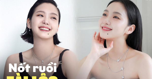 Nốt ruồi ở cằm dự báo điều gì về tài lộc hậu vận, điền sản đất đai?