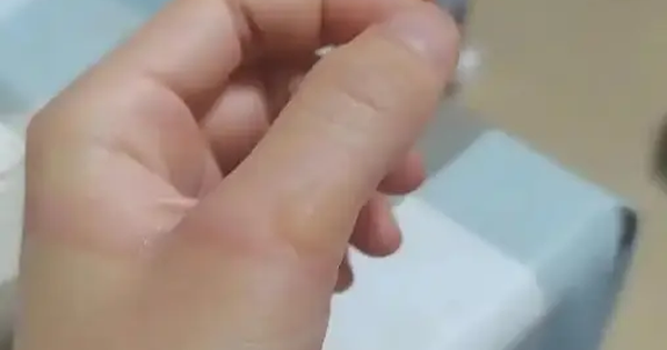 Bé trai 3 tuổi bị bỏng nước sôi 100 độ C, hành động của người bà trong “60 giây vàng” được bác sĩ khen ngợi