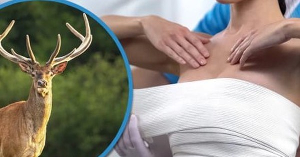 Bị lừa nâng ngực bằng collagen gia súc, cô gái biến dạng ngực, tốn 8,4 tỷ đồng