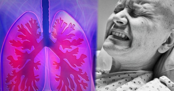 Ngoài thuốc lá, đây cũng là thủ phạm gây ung thư phổi đáng sợ: Cái cuối được mệnh danh là "sát thủ" trong nhà