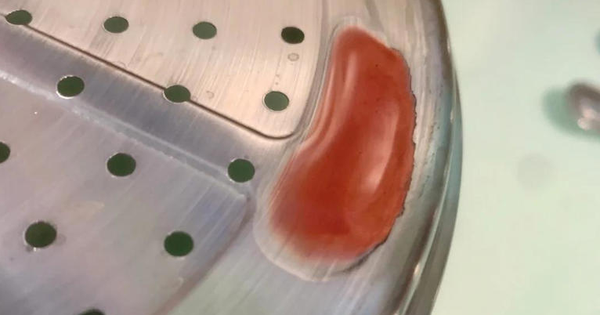 Nhanh chóng loại bỏ 5 thứ này ra khỏi bếp, tiếp xúc càng lâu càng nạp nhiều chất độc vào người: Bếp nhà nào cũng có