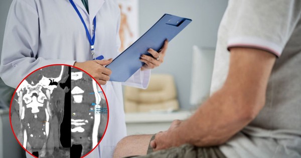 Tình cờ làm điều này, người đàn ông Hà Nội "thoát" đột quỵ trong gang tấc