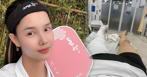 Từ vụ sao nữ Vbiz gãy xương đùi khi chơi pickleball, chuyên gia chỉ ra 4 lỗi sai cực nguy hiểm