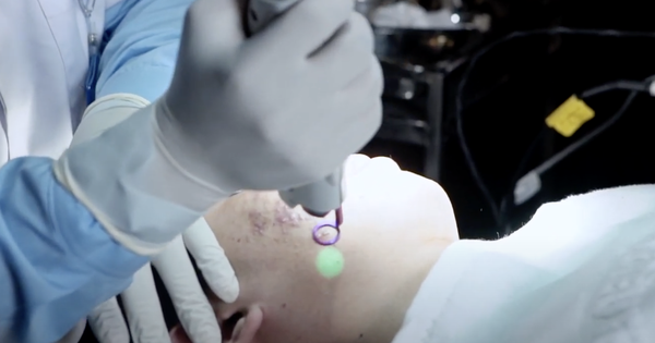 Sau ủ trắng da, cô gái nhập viện vì rối loạn nhịp tim