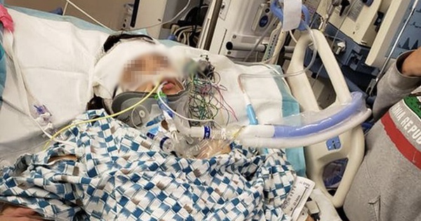 Chàng trai 23 tuổi bị đột quỵ trên bàn làm việc, phải cấp cứu mở hộp sọ, di chứng liệt nửa người: Chạy KPI ‘thêm 1 chút’ để rồi ‘chậm cả đời’