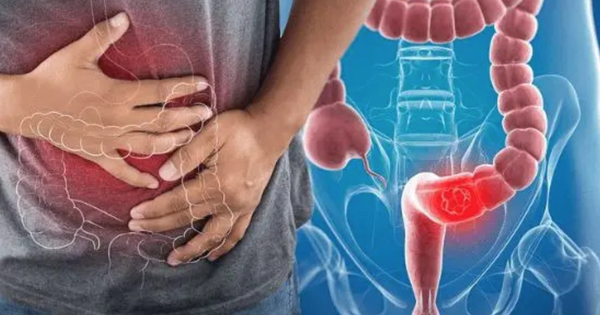 Bác sĩ Bạch Mai hé lộ “hạt giống” khởi nguồn cho ung thư, khuyên làm 1 việc để loại bỏ 90% nguy cơ