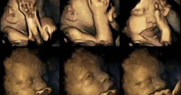 Nghiên cứu Mỹ: Chồng hút thuốc, vợ sảy thai, đứa trẻ chưa ra đời đã phải học cách chịu đựng khói thuốc