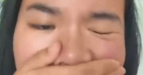 Người phụ nữ 25 tuổi bị liệt mặt sau giấc ngủ trưa, bác sĩ đưa ra cảnh báo