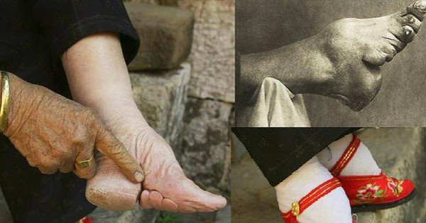 Cô gái 15 tuổi lấy chồng giàu nhờ "gót sen ba tấc" nhưng cái giá phải trả là thanh xuân bị bóp nghẹt đau đớn