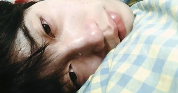 Soi làn da ra ngay bệnh gan: Thấy 3 kiểu “đỏ, đen, vàng” này đi khám nhanh còn kịp!