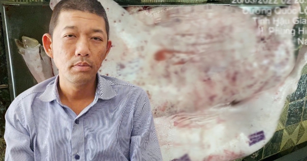 Người tố công ty C.P bán heo bệnh đã nhận được bao nhiêu tiền từ BHYT, trước khi phải tự bỏ tiền túi chạy thận?