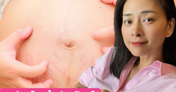 Mang thai ở tuổi 46, Ngô Thanh Vân bị ứ mật trong gan: Biến chứng thai kỳ này đe dọa mẹ và con thế nào?