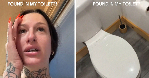 Người phụ nữ được yêu cầu đến thẳng bệnh viện sau khi phát hiện "sinh vật đáng sợ" trong phòng tắm