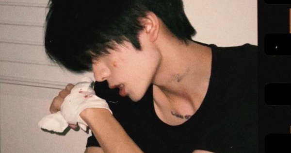 Trước khi xương bị "NUỐT CHỬNG" bởi ung thư, cơ thể sẽ báo cho bạn bằng 6 cách