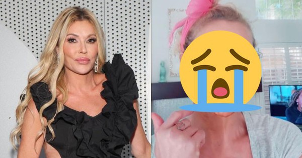 Nữ diễn viên mặt bị "ăn mòn" từng mảng, biến dạng nghiêm trọng vì lí do gì?