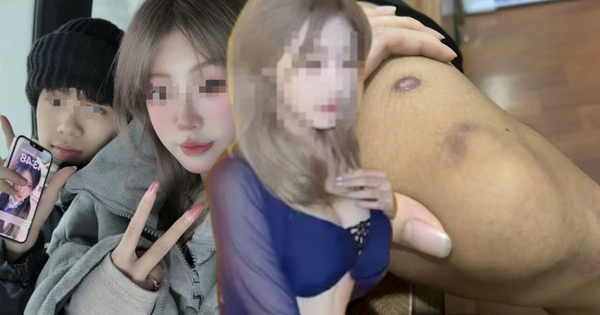 Chàng trai 19 tuổi bị bạn gái 17 tuổi bán sang Myanmar với giá 365 triệu đồng