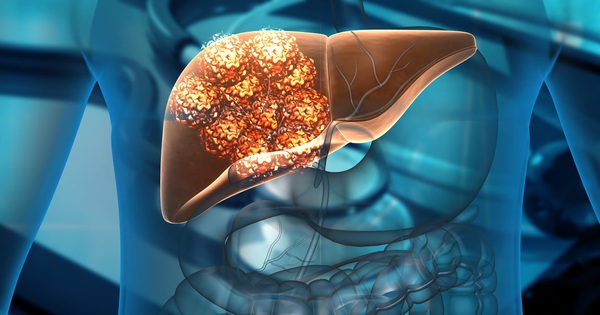 Người có gan yếu thường có 7 thói quen này: Cái cuối cùng nhiều người không ngờ tới