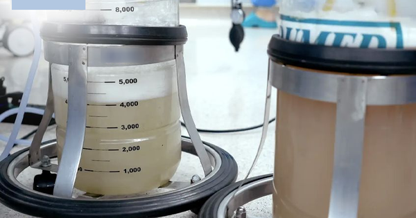 Hút ra gần 30 lít dịch đục "như bùn" từ phổi người đàn ông