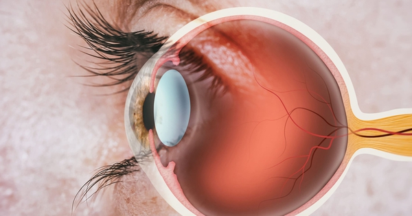 Thận khỏe hay không, nhìn mắt cũng biết: Có 5 dấu hiệu này hãy cẩn trọng