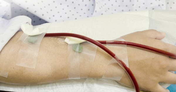 Ăn uống lành mạnh, chăm tập thể dục nhưng phải cắt cả 2 thận chỉ trong vòng 1 năm: "Thủ phạm" lộ diện