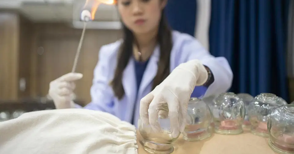 Liệt nửa người sau khi cạo gió giác hơi