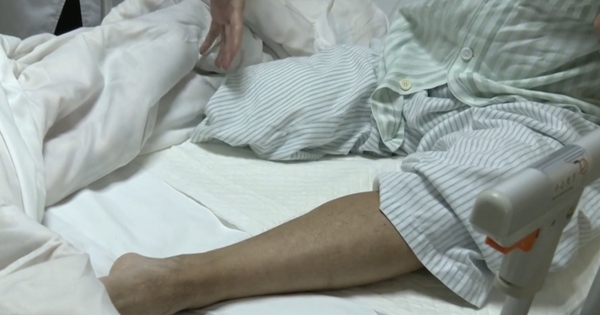 Người đàn ông bất ngờ phải cắt cụt bắp chân: Bác sĩ nói do chủ quan với 1 dấu hiệu bất thường