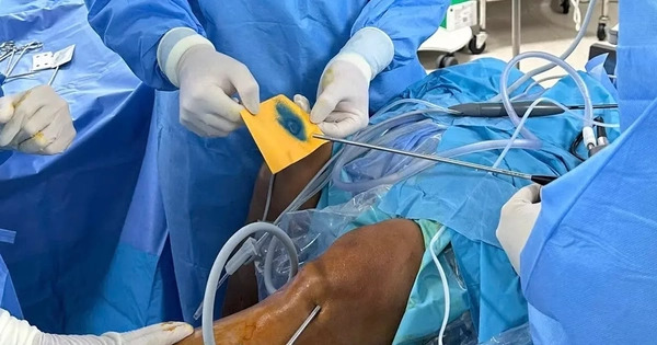 Việt Nam điều trị thành công thoái hóa khớp bằng phương pháp hoàn toàn mới