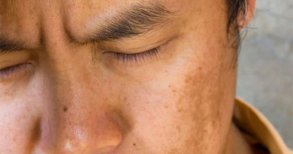 Cơ thể xuất hiện 4 biểu hiện bất thường này vào buổi sáng cảnh báo gan đang mang “mầm bệnh”: Có 3/4 thì phải đi khám ngay