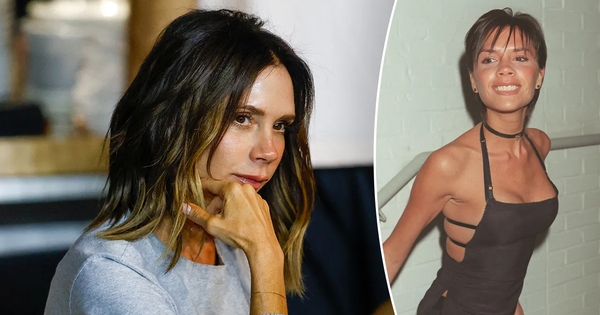 Victoria Beckham đã phải chịu đựng căn bệnh này suốt 25 năm qua