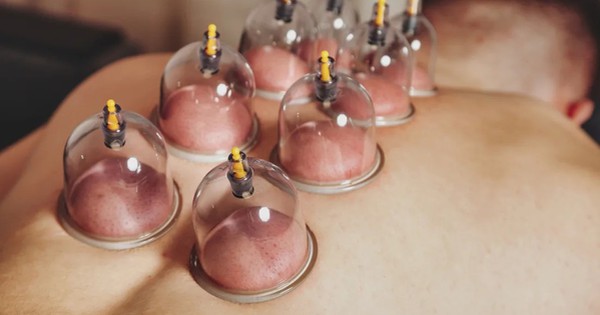 Giác hơi vùng cổ, người đàn ông 37 tuổi đột quỵ liệt nửa người: 1 thói quen TAI HẠI nhiều người Việt làm mỗi ngày