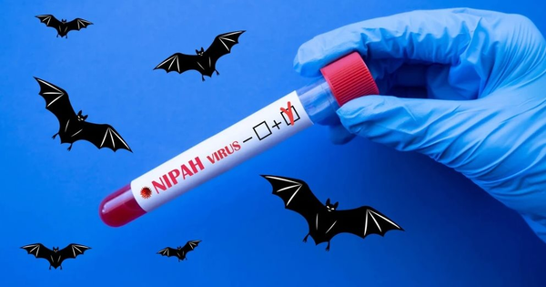 Dịch Nipah: 5 khuyến cáo từ Bộ Y tế mà mọi người cần biết