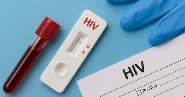 TP.HCM ghi nhận hơn 3.100 ca HIV mới trong vòng một năm, 81% ca lây nhiễm đến từ tình dục không an toàn