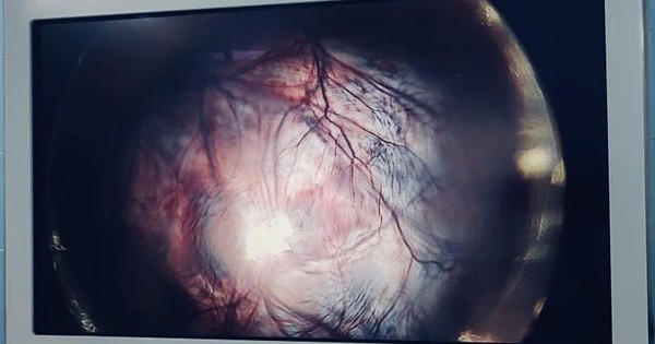 Giữ lại thiên chức làm mẹ cho bệnh nhân 22 tuổi