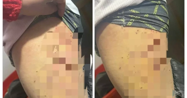 Học sinh Lào Cai bị bạn dùng bút bi đâm nhiều lần do tranh chấp chỗ ngồi