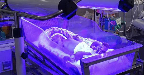 Bệnh viện Nhi Đồng 2 cứu sống bé sơ sinh 30 giờ tuổi mắc bất đồng nhóm máu hiếm