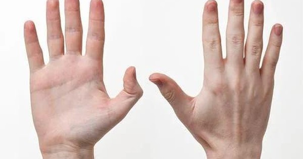Bàn Tay Cảnh Báo Sức Khỏe: 3 Dấu Hiệu Bất Thường Dễ Bỏ Qua Có Thể Liên Quan Đến Ung Thư