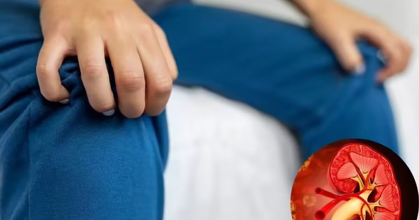 7 Dấu Hiệu Trên Tay Và Chân Cảnh Báo Sớm Bệnh Thận Cần Chú Ý