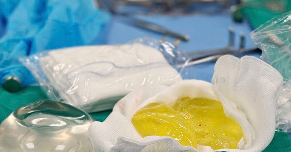 Phụ nữ Hà Nội trải qua ca phẫu thuật thay túi ngực sau khi phát hiện vỡ túi độn thầm lặng