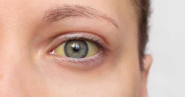 Cảnh Báo Ung Thư Tuyến Tụy: 4 Triệu Chứng 'Sát Thủ Thầm Lặng' Cần Đặc Biệt Chú Ý