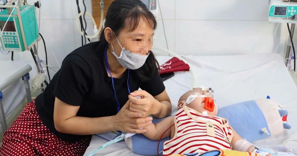 Bệnh tay chân miệng bùng phát: Hơn 25.000 ca, 8 tử vong, Thứ trưởng Bộ Y tế giám sát khẩn