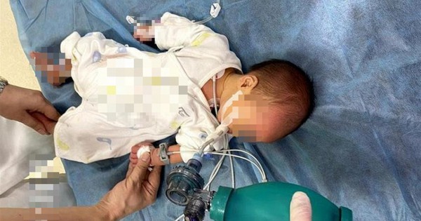 Cảnh báo ngộ độc Botulinum ở trẻ sơ sinh: Mật ong có thể thành 'liều thuốc độc'