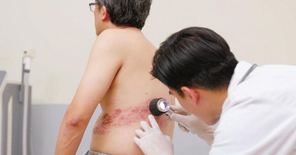 Khảo sát toàn cầu: Người mắc bệnh mạn tính lo ngại biến chứng nhưng chưa chủ động phòng ngừa