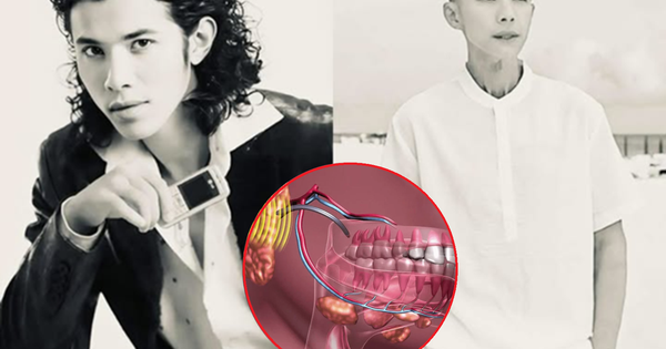 Kasim Hoàng Vũ qua đời vì 1 căn bệnh dễ bị bỏ qua: Triệu chứng ban đầu mờ nhạt, những ai cần đặc biệt cảnh giác?