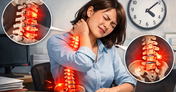 Cảnh báo: Người trẻ 'già hóa' cột sống vì thói quen ngồi nhiều, sai tư thế