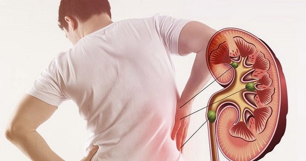 Cảnh báo: 4 dấu hiệu sớm cho thấy thận đang suy yếu, đừng bỏ qua