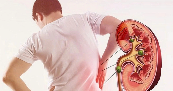 Suy Thận Không Còn Là Bệnh Của Người Già: Cảnh Báo Từ Thói Quen Sinh Hoạt Hàng Ngày